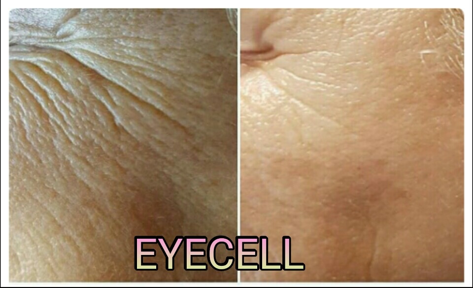 EYECELL GÖZ ÇEVRESİ BAKIMIMIZ