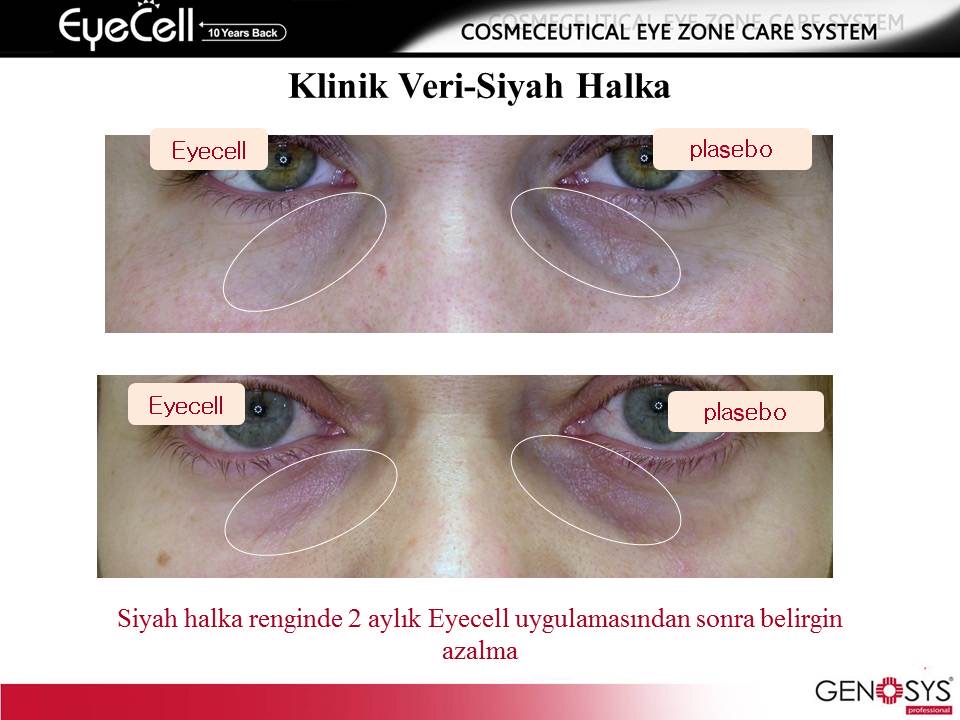 EYECELL GÖZ ÇEVRESİ BAKIMIMIZ