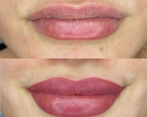 Çanakkale Kleopatra Güzellik Salonu'nda uzmanlar tarafından yapılan Dudak Renklendirme uygulaması