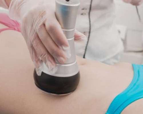 Çanakkale Kleopatra Güzellik Salonu'nda uzmanlar tarafından yapılan Radyo Frekans ile sıkılaşma uygulaması