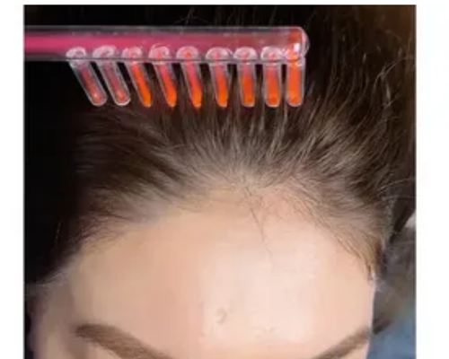 Çanakkale Kleopatra Güzellik Salonu'nda uzmanlar tarafından yapılan saç vitamini uygulaması