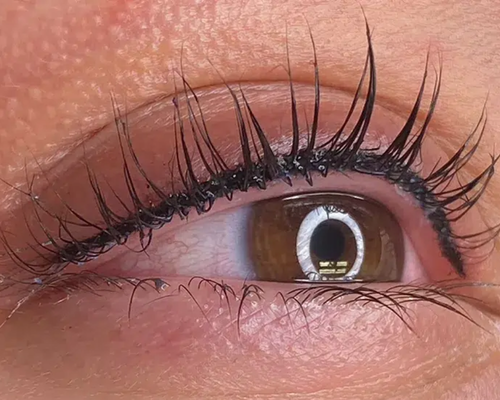 Çanakkale Kleopatra Güzellik Salonu'nda uzmanlar tarafından yapılan Dipliner uygulaması