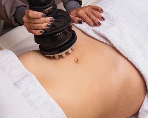 Çanakkale Kleopatra Güzellik Salonu'nda uzmanlar tarafından yapılan G5 selülit masajı uygulaması